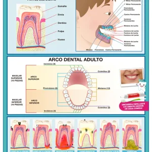 Póster Los dientes